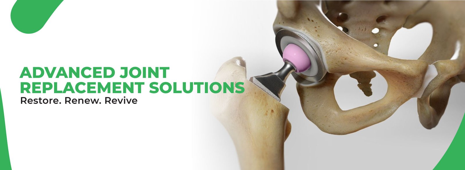 Joint Replacement and Preservation